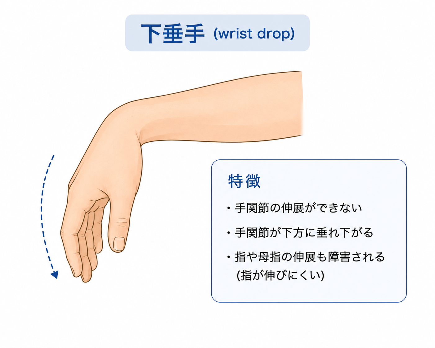 下垂手