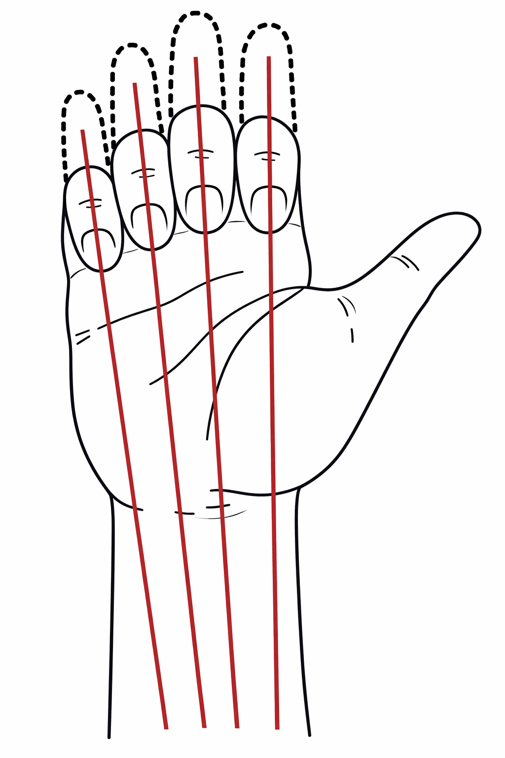 PIP関節の屈曲時には指は回旋しない