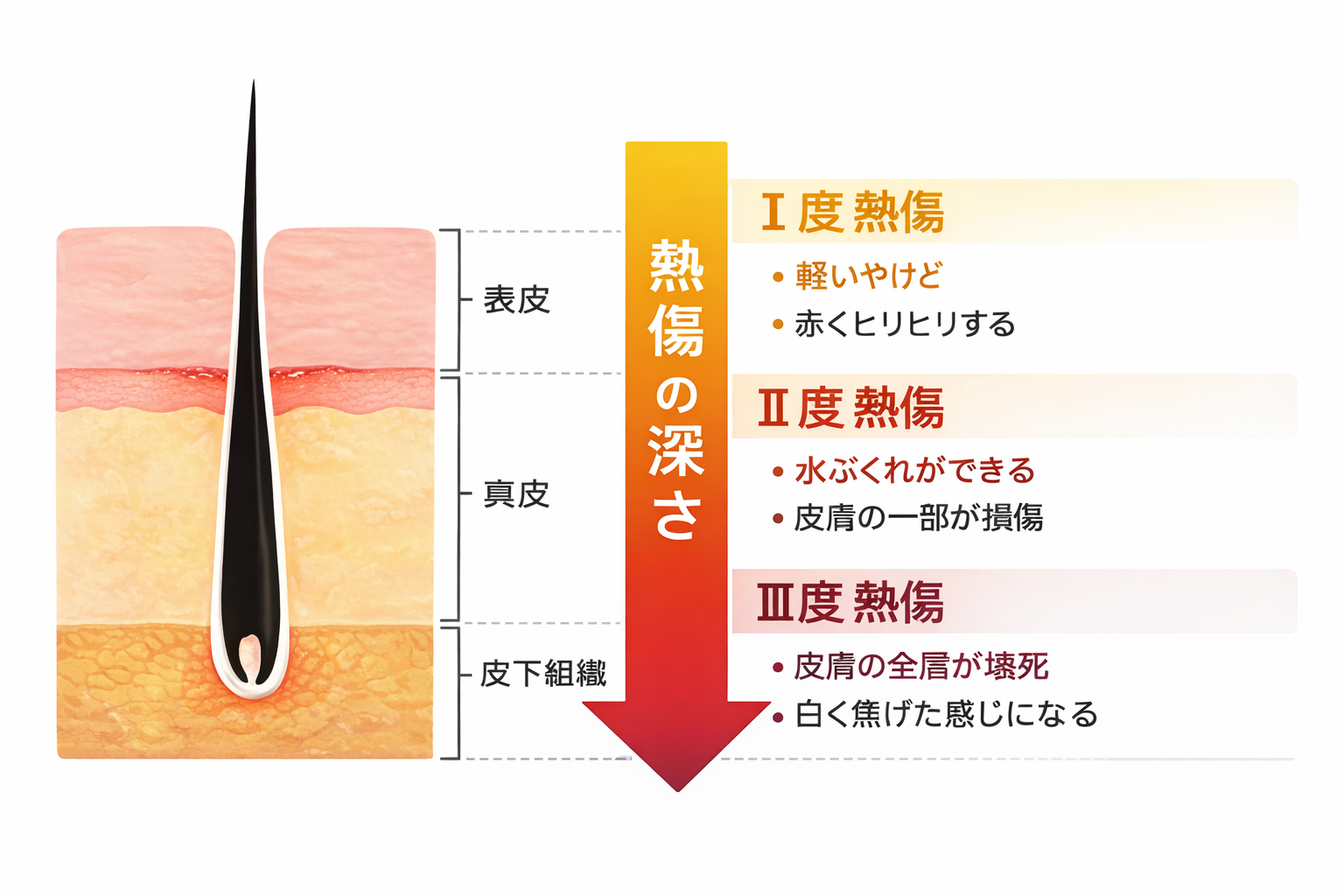 オーバルエイト