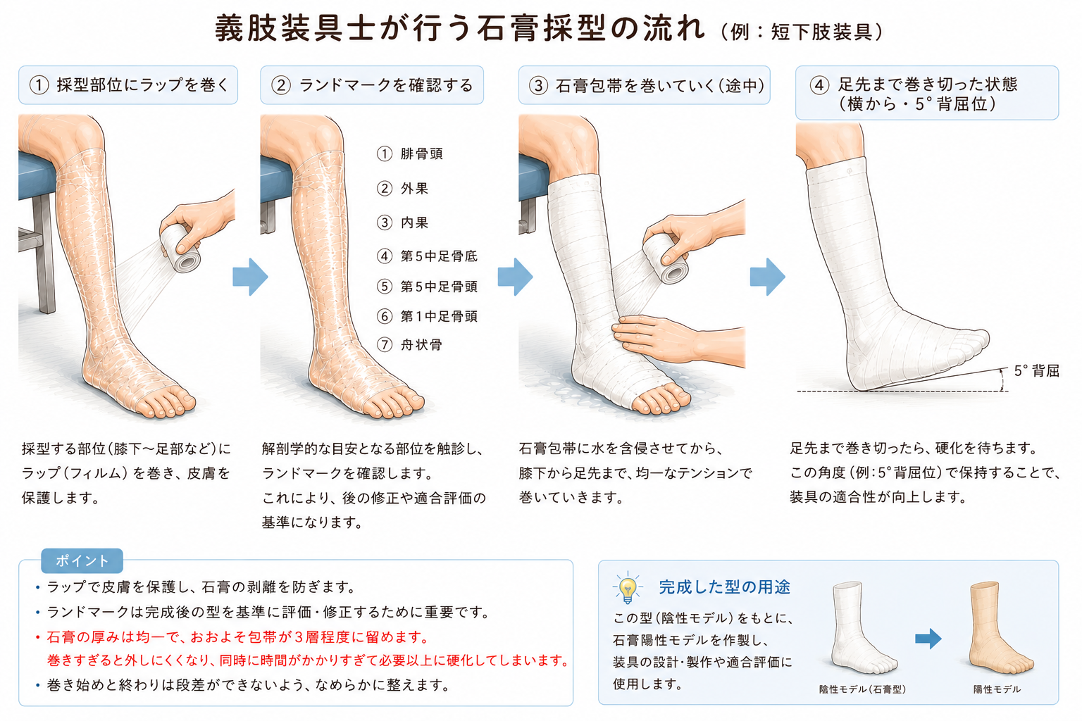 例：短下肢装具の採型
