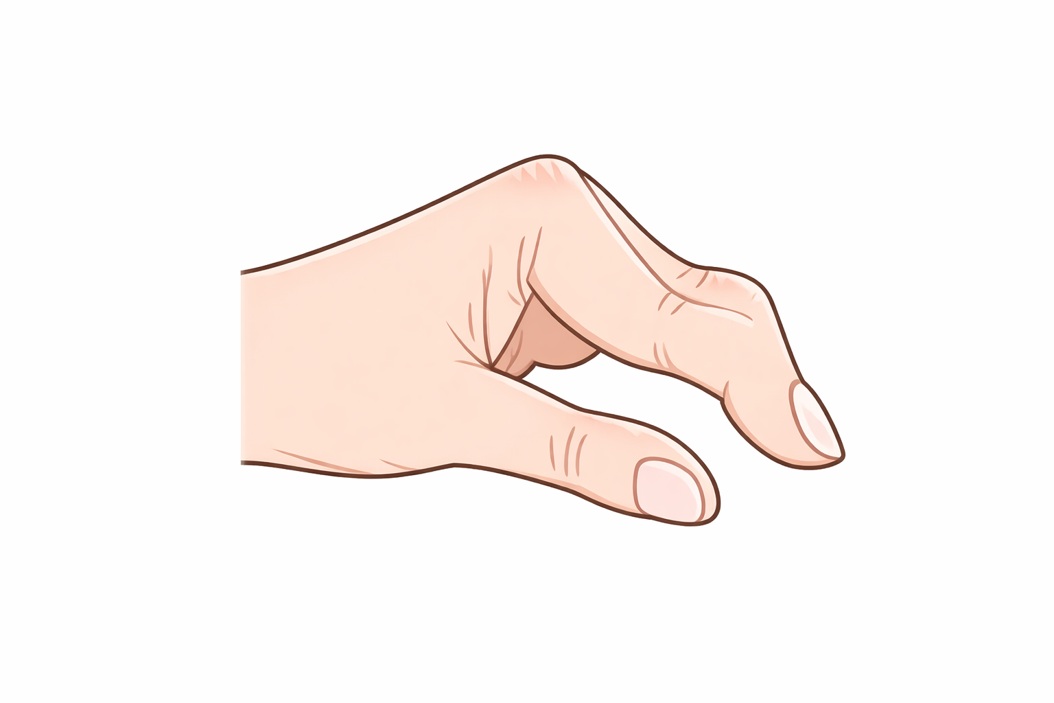 スワンネック変形