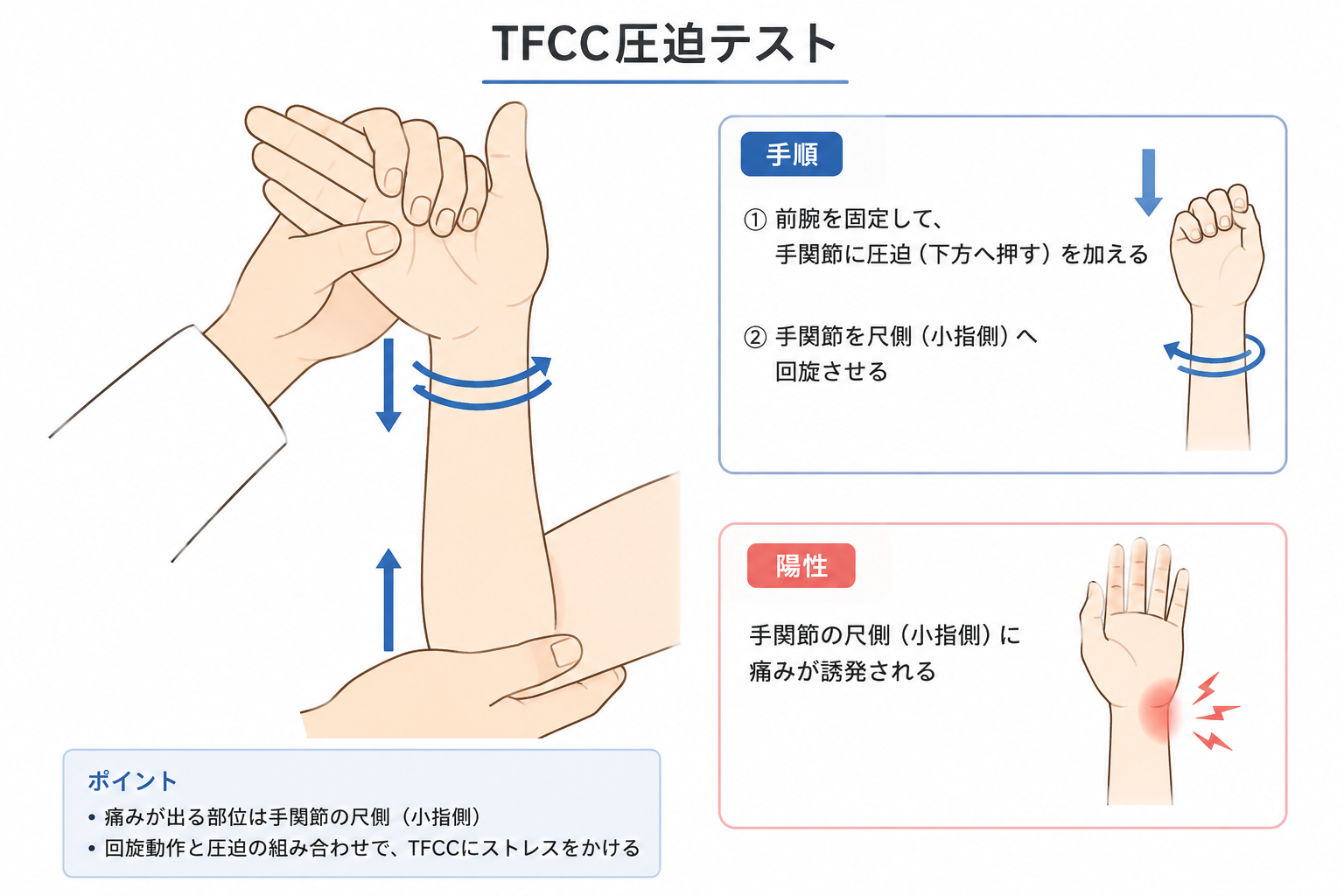 TFCC圧迫テスト